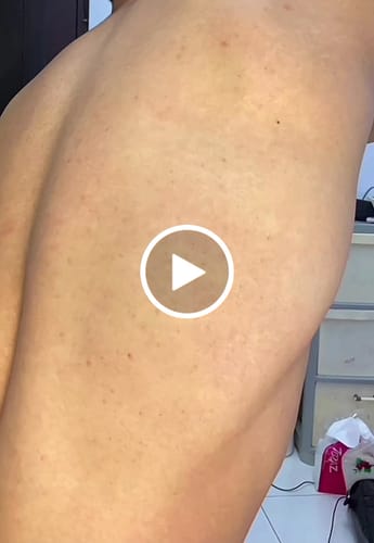 Customer video review of Skin Clearing Honey & Turmeric Bar