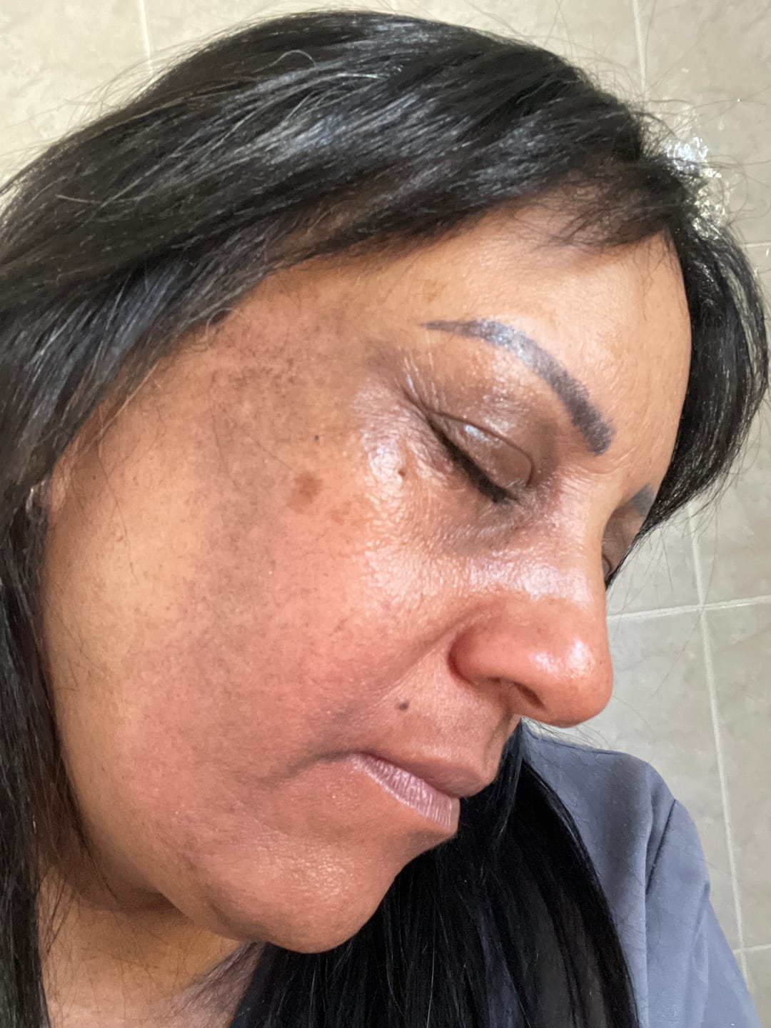 Customer photo review of Gmaeum Hyperpigmentation Capsules (3 Months Supply)