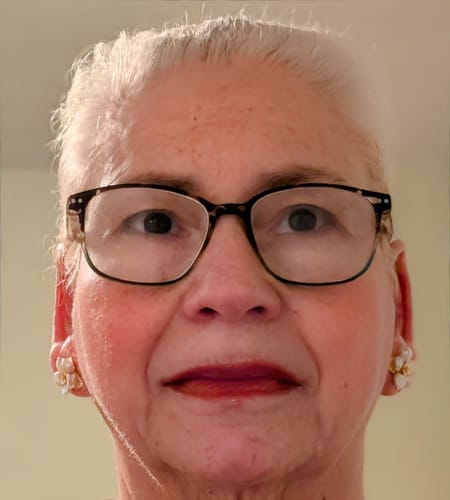 Customer photo review of FLOWER - White Keshi Pearl Stud Earrings