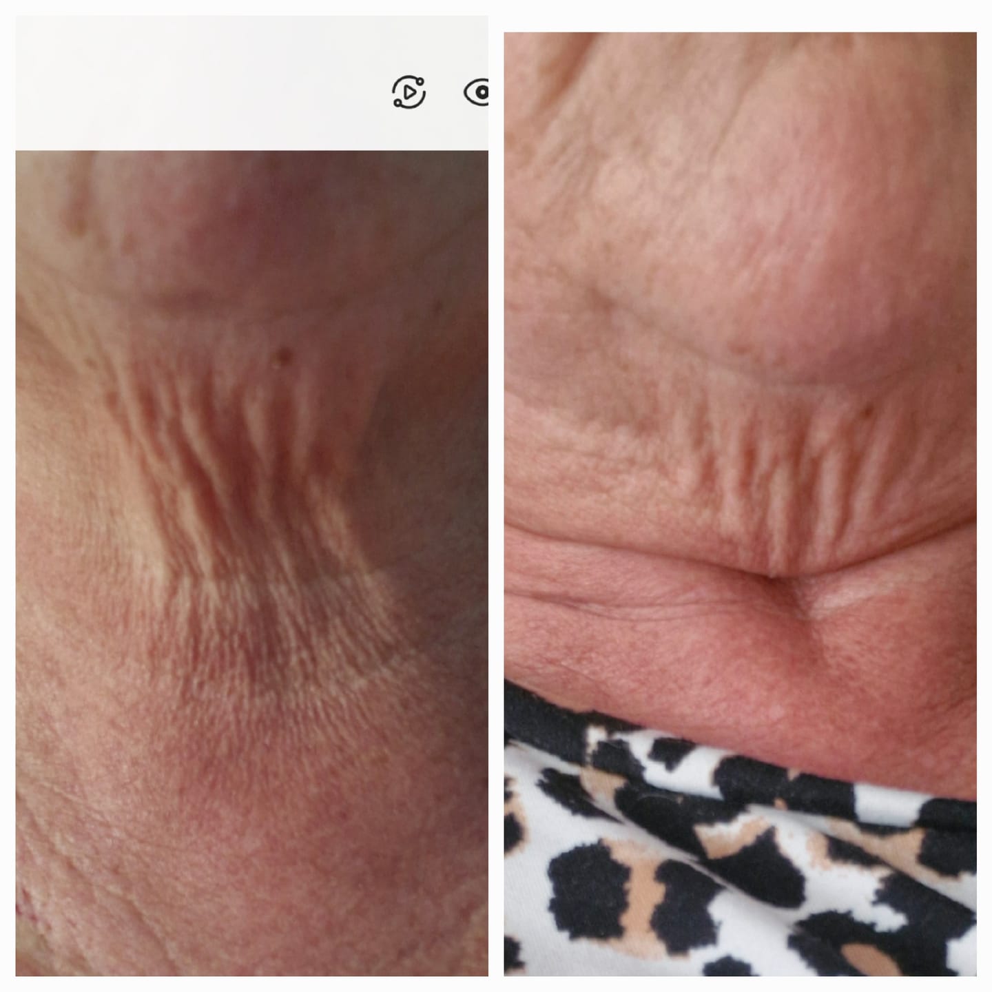 Customer photo review of Peptide Face & Neck Night Cream 50ml