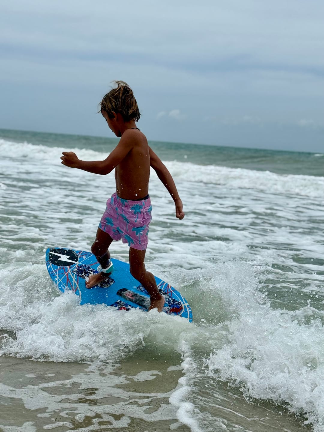 Customer photo review of Sharkbanz 2 – Wearable Shark Deterrent