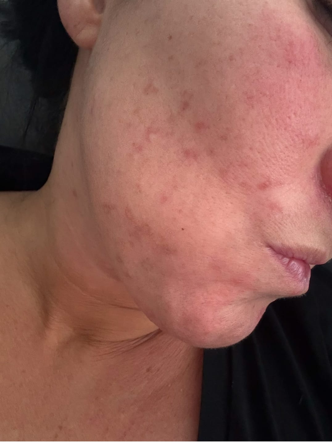 Customer photo review of Oercrème Tallow
