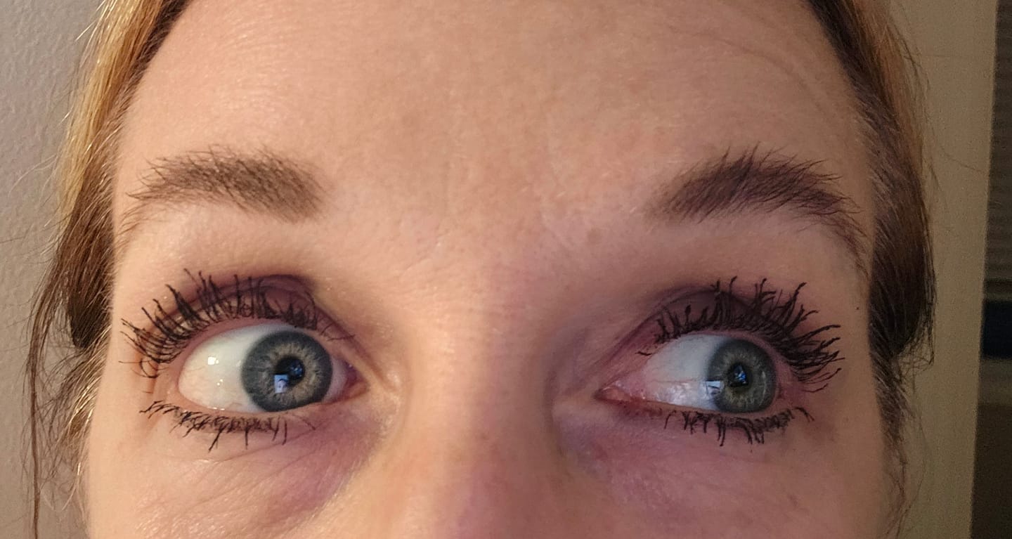 Customer photo review of EYELASH GROWTH SOLUTION