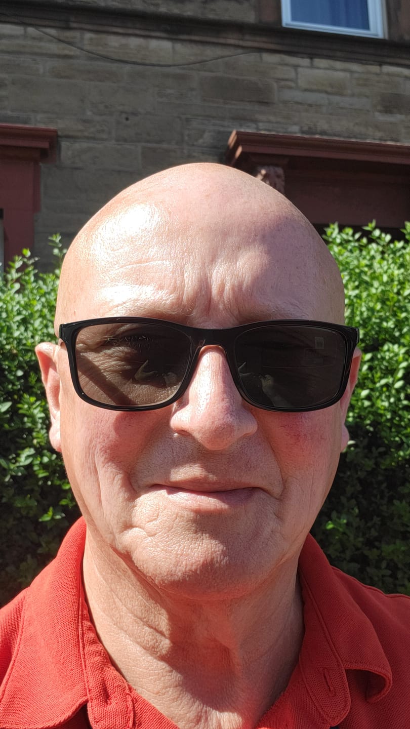 Customer photo review of Trimpod 3.0: The Ultimate Shaver for Bald Men