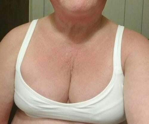 Customer photo review of HexoBra™ Posture Corrector