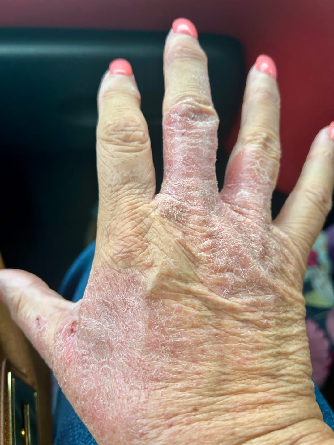 Customer photo review of Prebiotic Hand Cream
