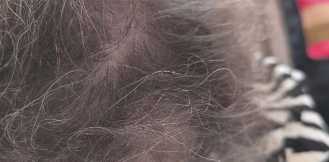 Customer photo review of Detangler