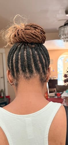 Customer photo review of Four Bottles of Rennora Hair Growth Serum