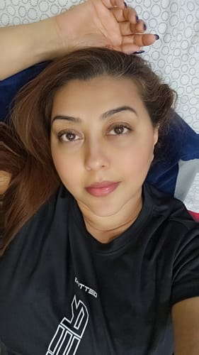 Customer photo review of Suroskie Glow Grain Rice Enzyme Cleanser - Gentle Exfoliation, Refine Pores, Strenghtens & Brightens Skin, Safe For All Skin Types (50gm)
