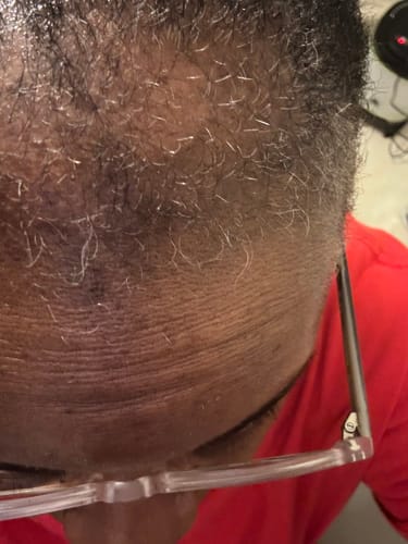 Customer photo review of Rennora Hair Growth Serum