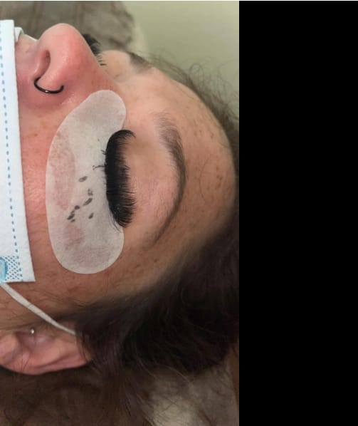 Customer photo review of Eye Pads 100Pairs