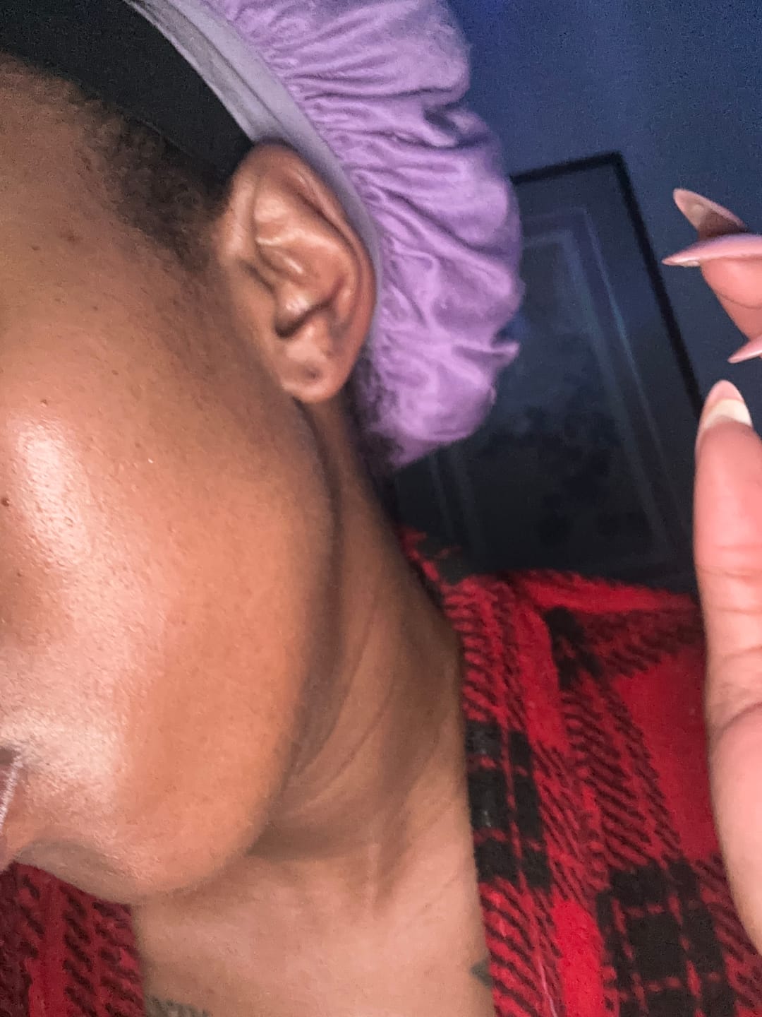 Customer photo review of 2in1 Double Cleansing Bar | Half Discoloration Brightening corrector | Half Oat Relief Acne Exfoliant