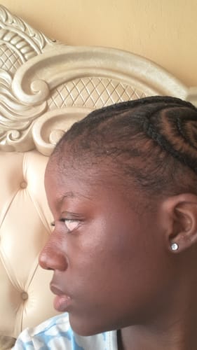 Customer photo review of NOVIFUL Hair Growth Serum - 3 PACK (3 Month supply)