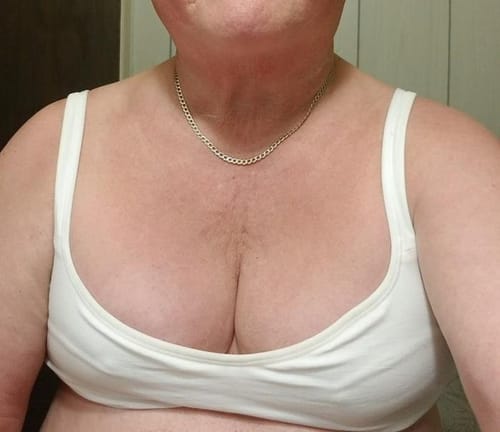 Customer photo review of HexoBra™ Posture Corrector