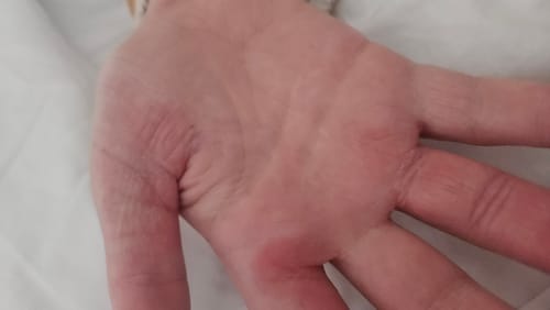 Customer photo review of MYLASMOSS SEAMOSS GEL (720ML)