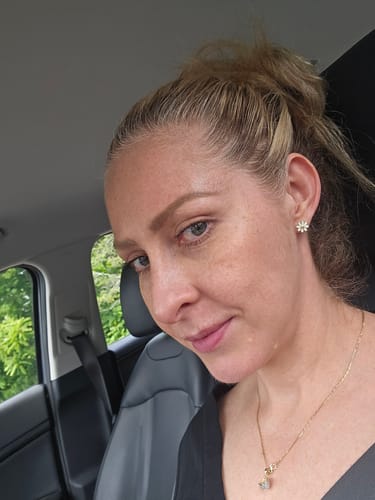 Customer photo review of Retinolic Serum