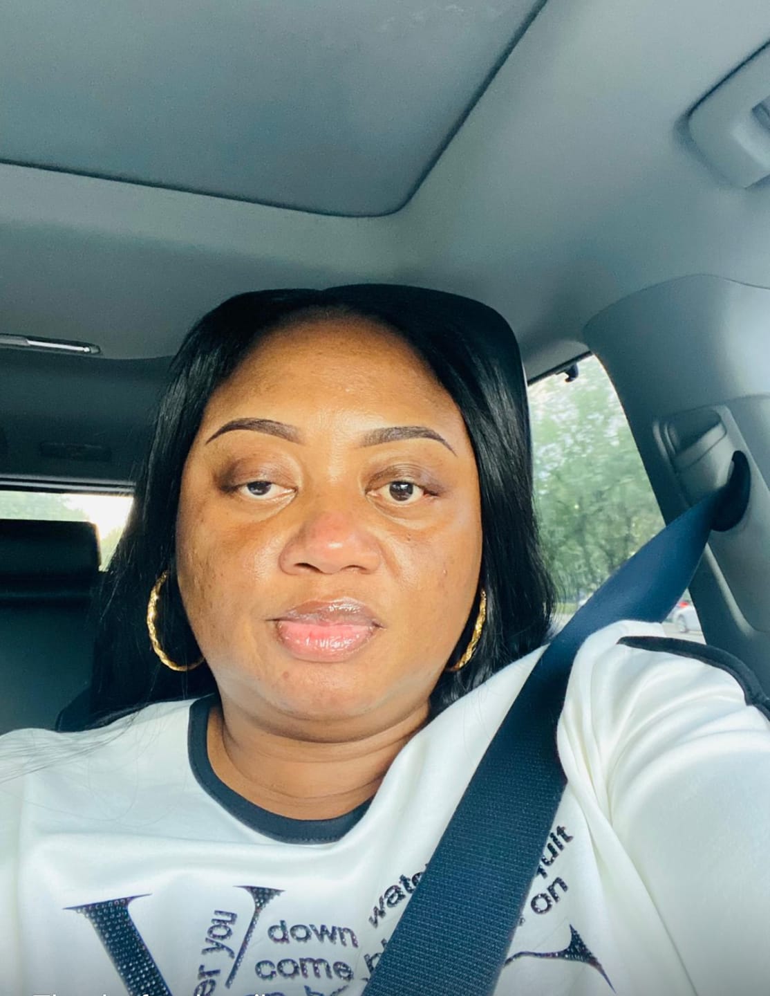 Customer photo review of Organic Extract of Papaya Brightening Gel Tube | 30g | 1Oz