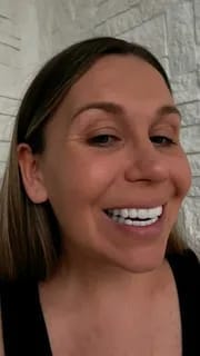 Customer photo review of Official Store | DIYSTAR™ Moldable Dentures🧑🏽‍⚕️Obtain American Dental Association (ADA) Certification ✅