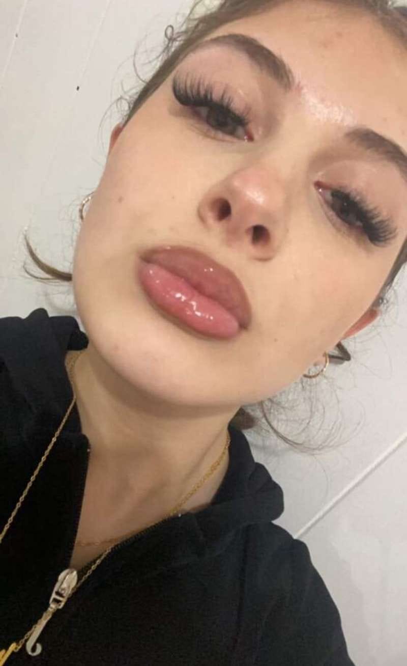 Customer photo review of Kit Repulpant Lèvres Novaa® – Lip Boost Naturel
