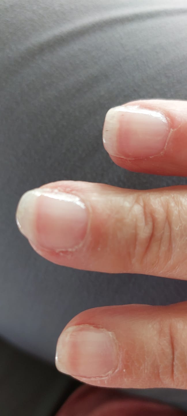 Customer photo review of Crystal Clear Dipping Powder