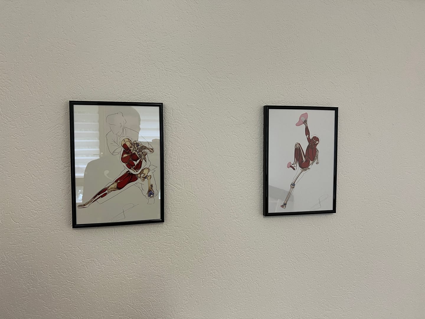 Customer photo review of Écorché Anatomique du Judo