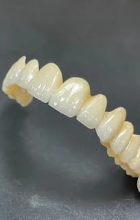 Customer photo review of Official Store | DIYSTAR™ Moldable Dentures🧑🏽‍⚕️Obtain American Dental Association (ADA) Certification ✅