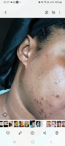 Customer photo review of HUILE DE PAPAYE ET VITAMINE C -EXTRA SHINE