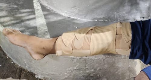 Customer photo review of Knee Brace - Long (19" Brace) | Ideal firm Knee support that limits knee motion & stabilizes the knee with mediolateral metal supports | Color - Beige