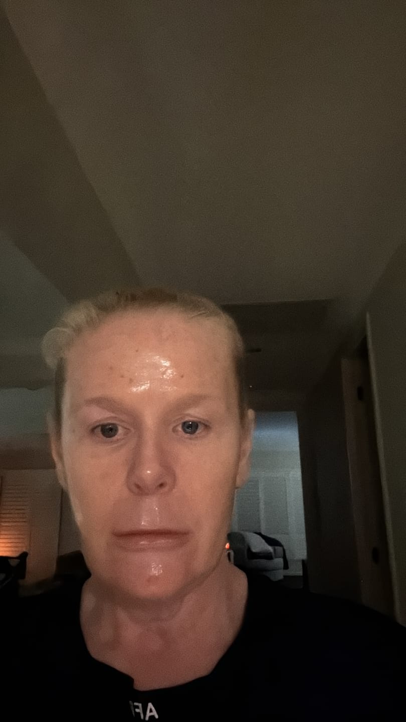 Customer photo review of The Naked Skin™ Collagen Overnight Wrapping Mask