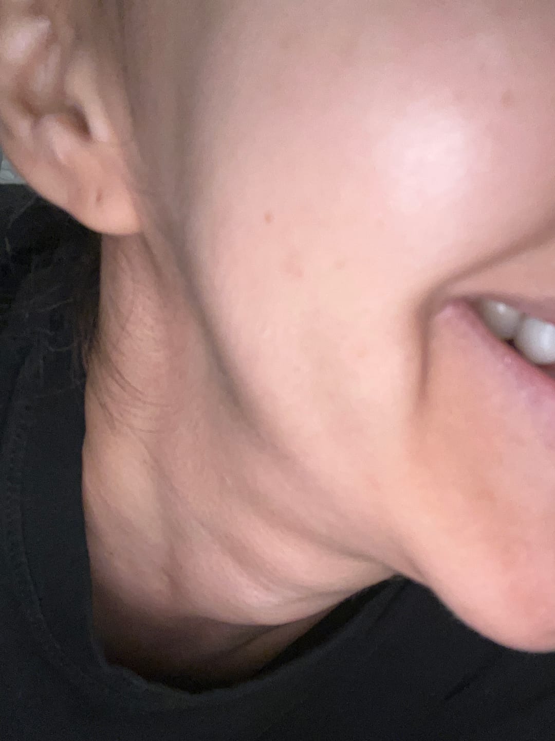 Customer photo review of Royal Jelly Daily Moisturizer