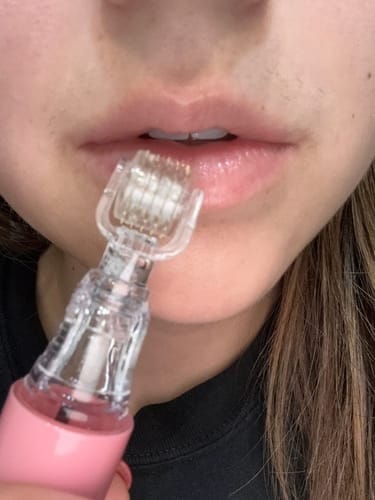 Customer photo review of Kit Repulpant Lèvres Novaa® – Lip Boost Naturel