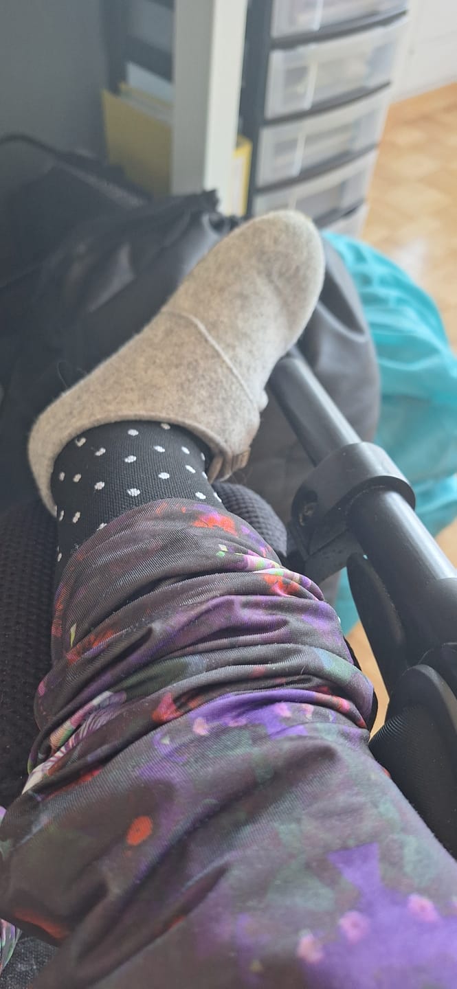 Customer photo review of VitalFlowPro™️  Premium Kompressionsstrümpfe