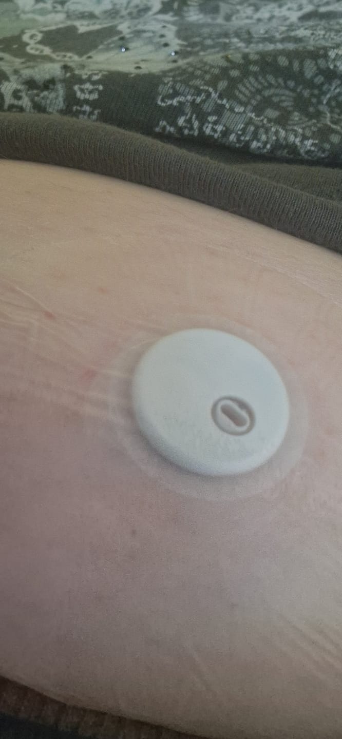 Customer photo review of Transparent CGM Patch för Freestyle Libre 1, 2 & 3
