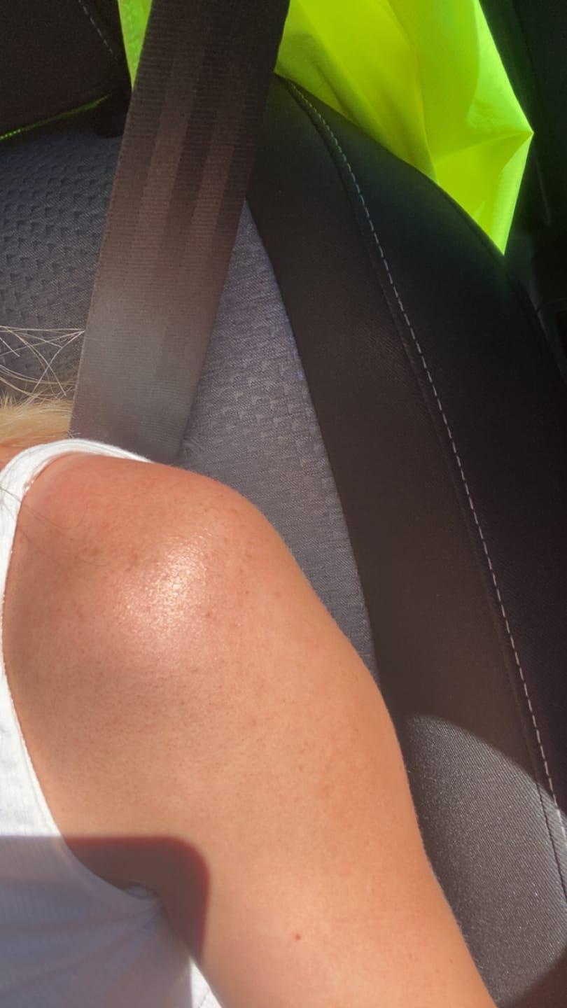 Customer photo review of Antiac Activ Liquid Spray