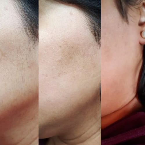Customer photo review of SkinUp Clásica