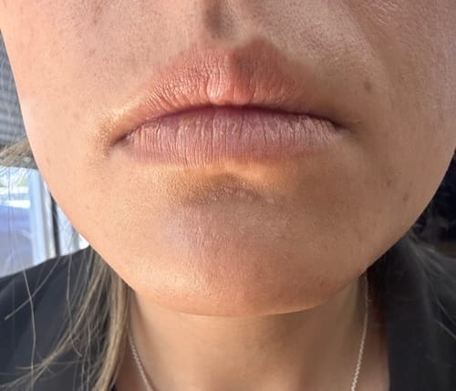 Customer photo review of SkinUp Clásica