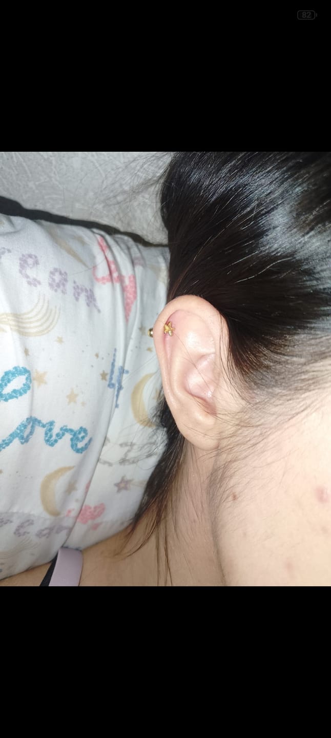 Customer photo review of Piercing Starfish