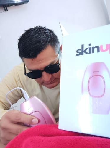 Customer photo review of SkinUp Clásica