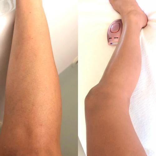 Customer photo review of SkinUp Clásica