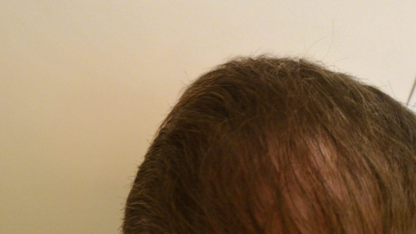 Customer photo review of GR-7 PRO