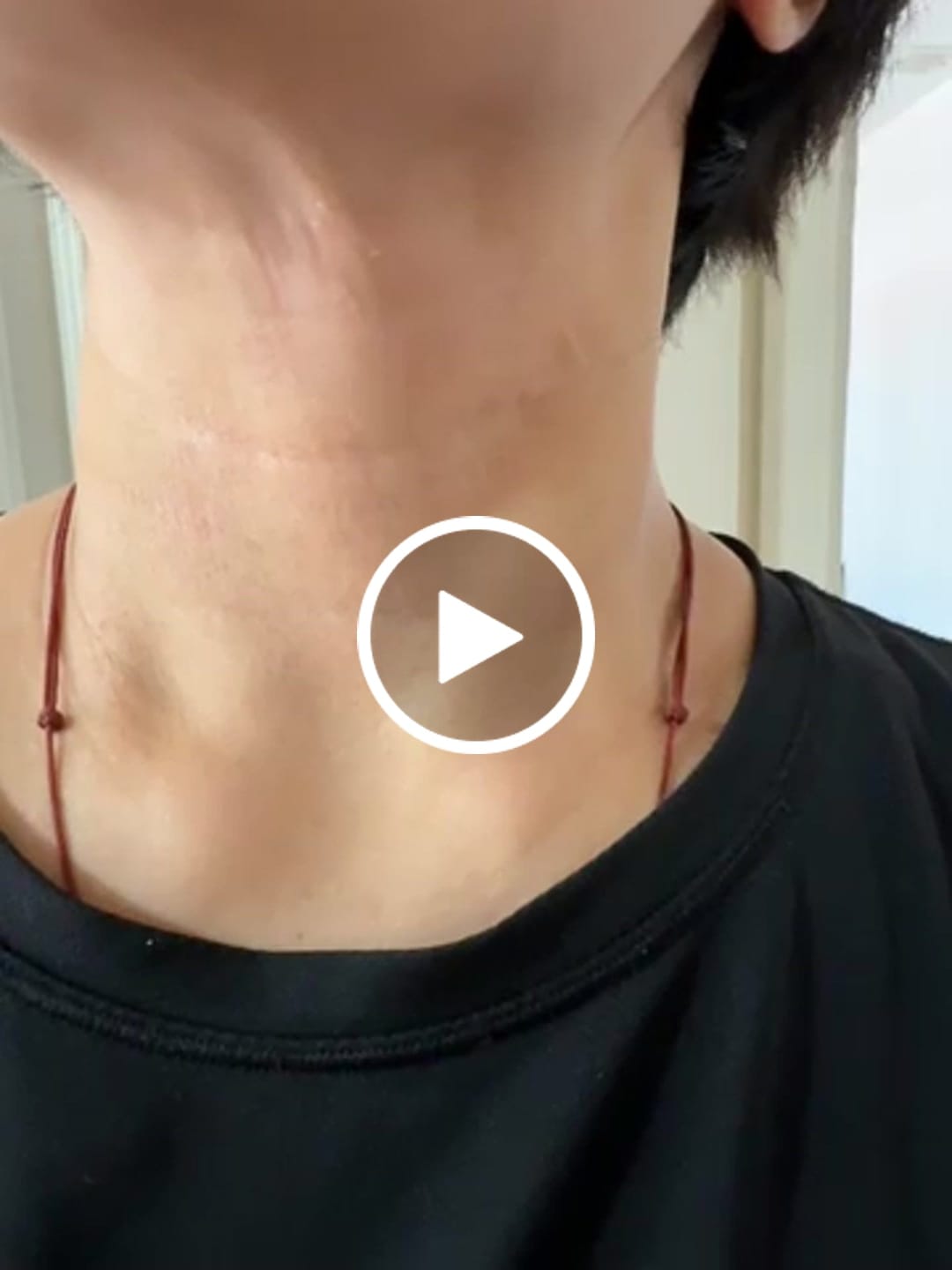 Customer video review of Vibrant Combo (4 RCV + 1 NSE)