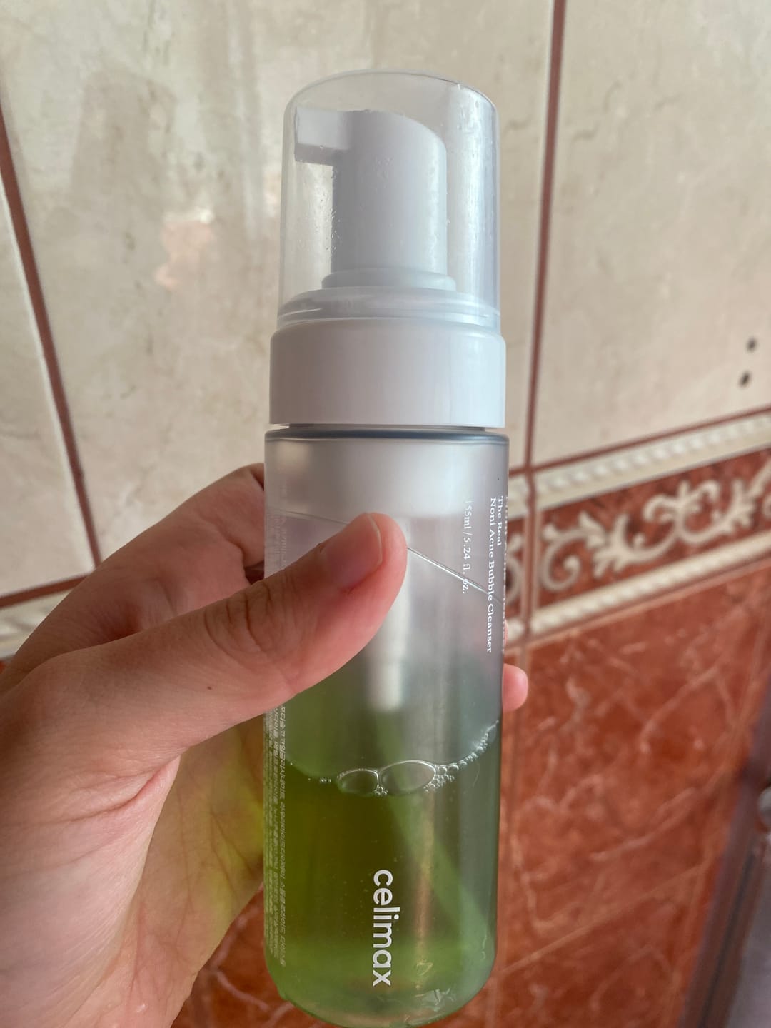 Customer photo review of The Real Noni Acne Bubble Cleanser