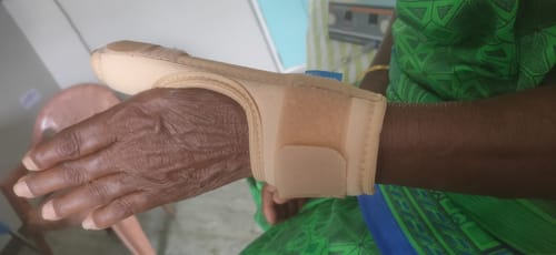 Customer photo review of Thumb Spica Support for Both Left/Right - Locks the Thumb Free Hand Movement for Men & Women | Thumb Injuries, Pain Solution for Ligament laxity (Beige)