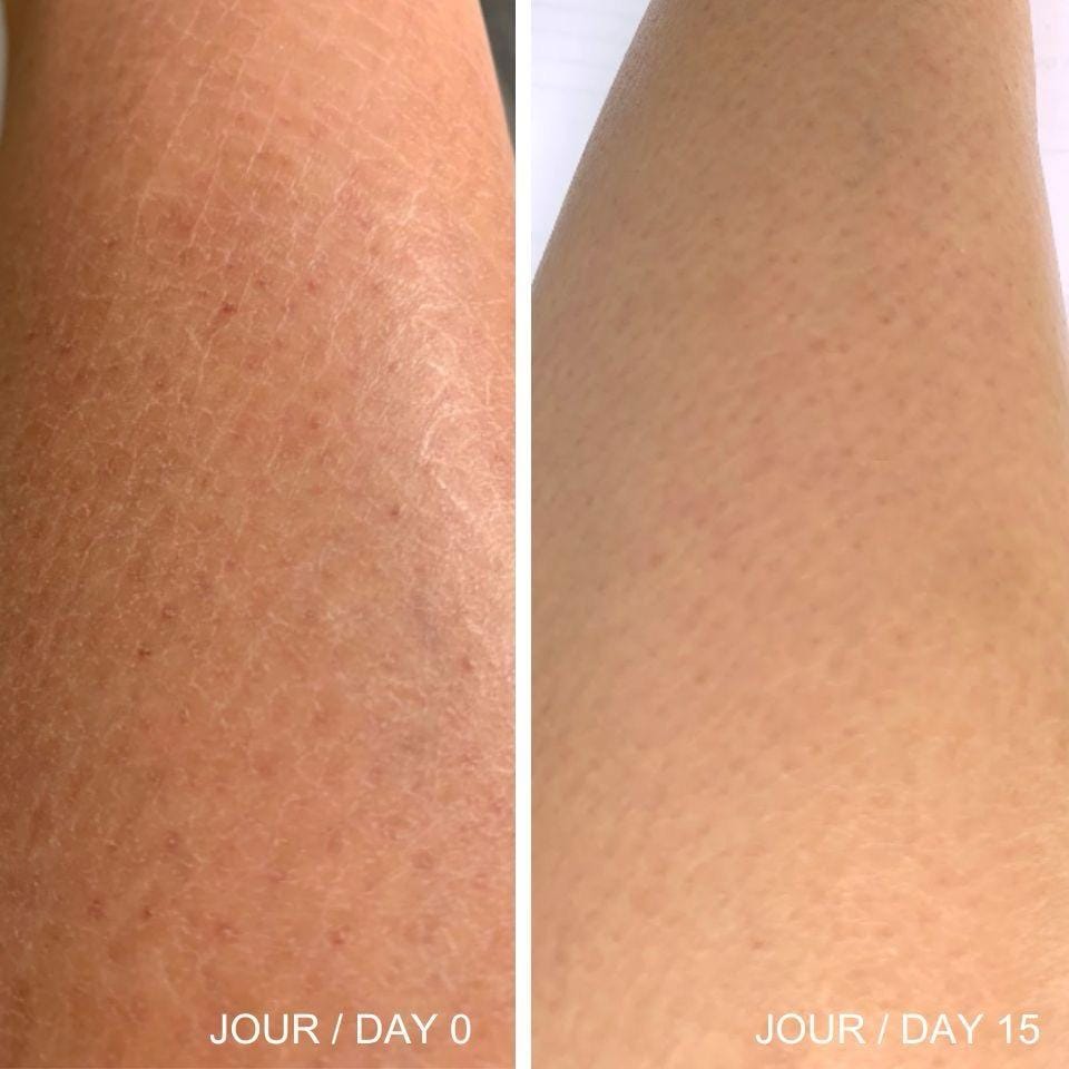 Customer photo review of HUILE DE PAPAYE ET VITAMINE C -EXTRA SHINE