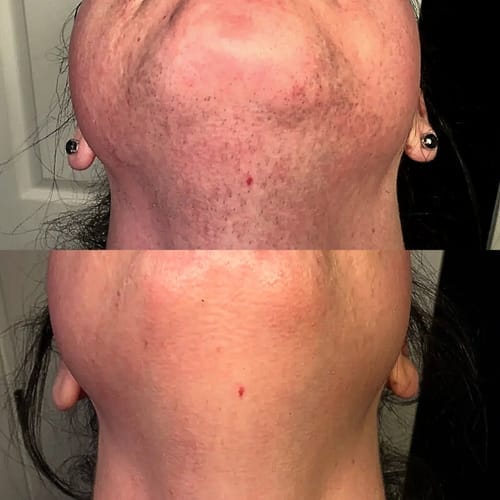Customer photo review of SkinUp Clásica
