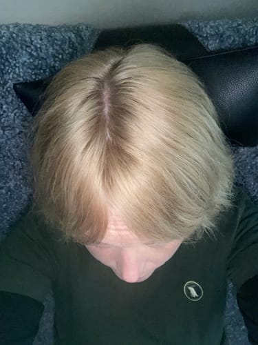 Customer photo review of Sunkissed Refill 3-pack