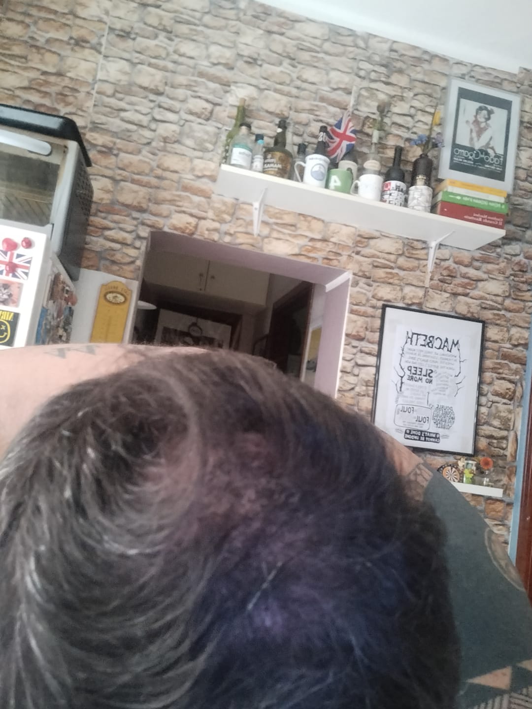 Customer photo review of Fibre copri Calvizie da 12gr  | Castano Scuro | 30 Giorni di applicazioni