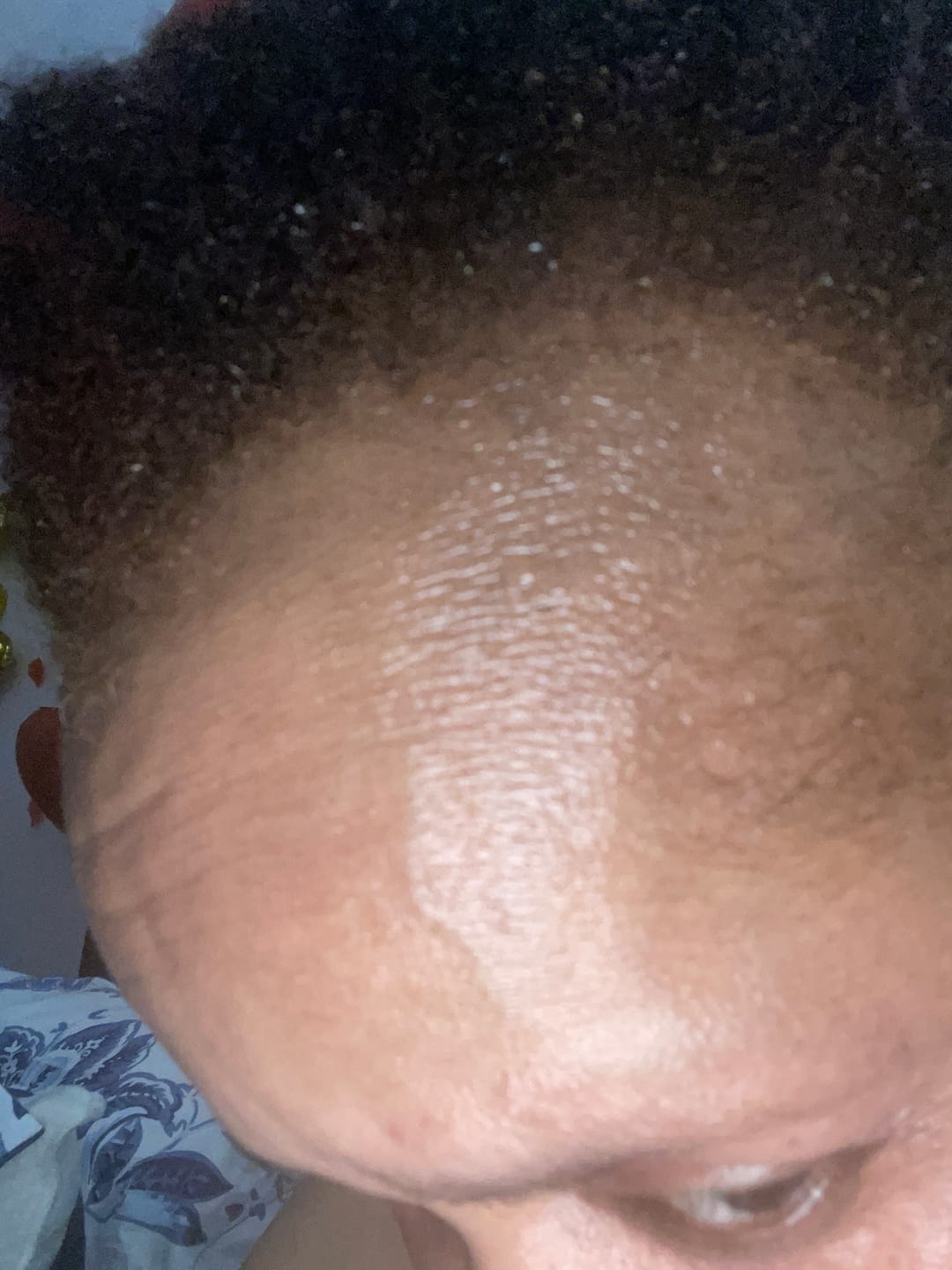 Customer photo review of Batana Oil for Hair