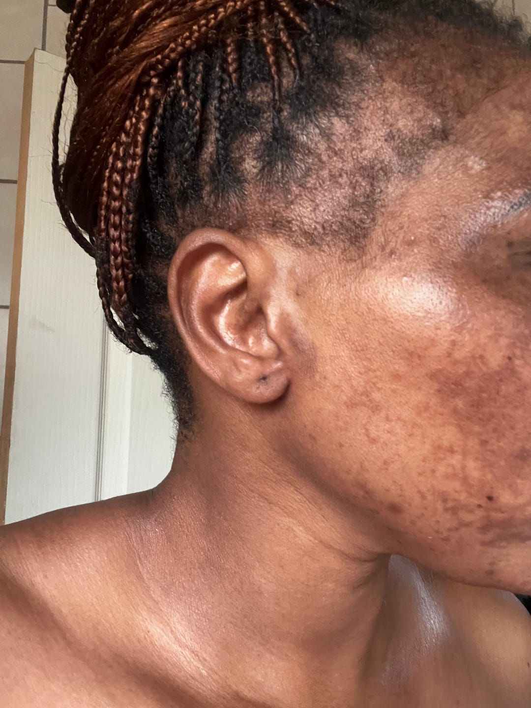 Customer photo review of Gmaeum Radiance and Renewal Set