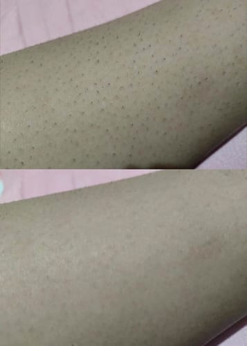 Customer photo review of SkinUp Clásica